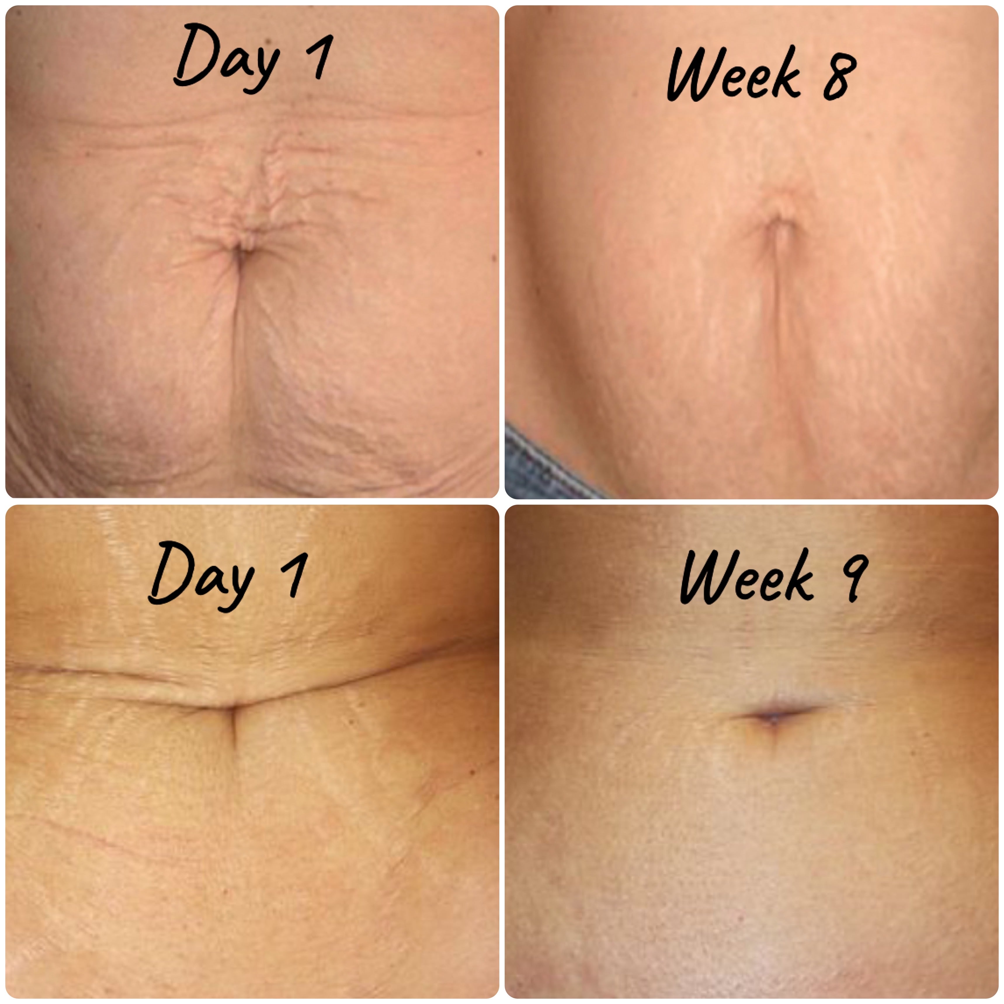 Waist Firming & Shaping Cream
