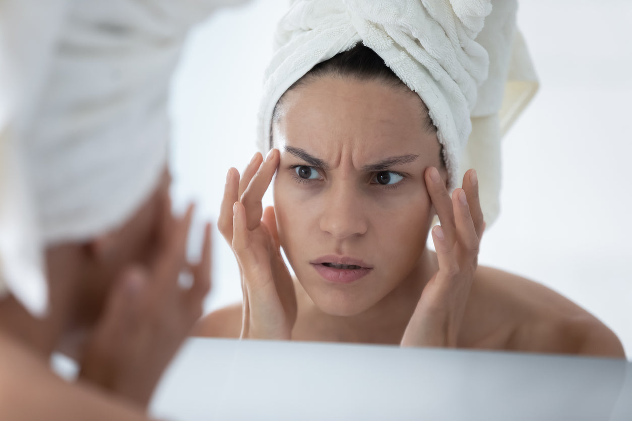 How Stress Affects The Skin